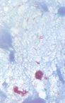 Leprosy mycobacterium