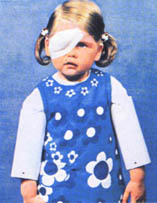 امراض العيون بالصور المفصلة؟؟ وخاصة فى الاطفال